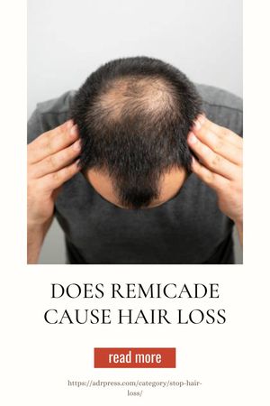 Metformin Hair Loss Recovery