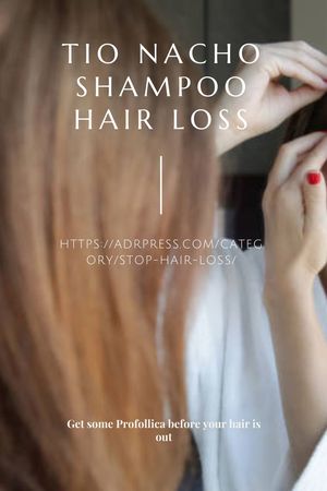 Tio Nacho Shampoo Hair Loss
